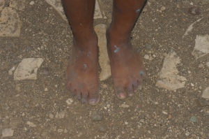 These little feet went to help spread the word